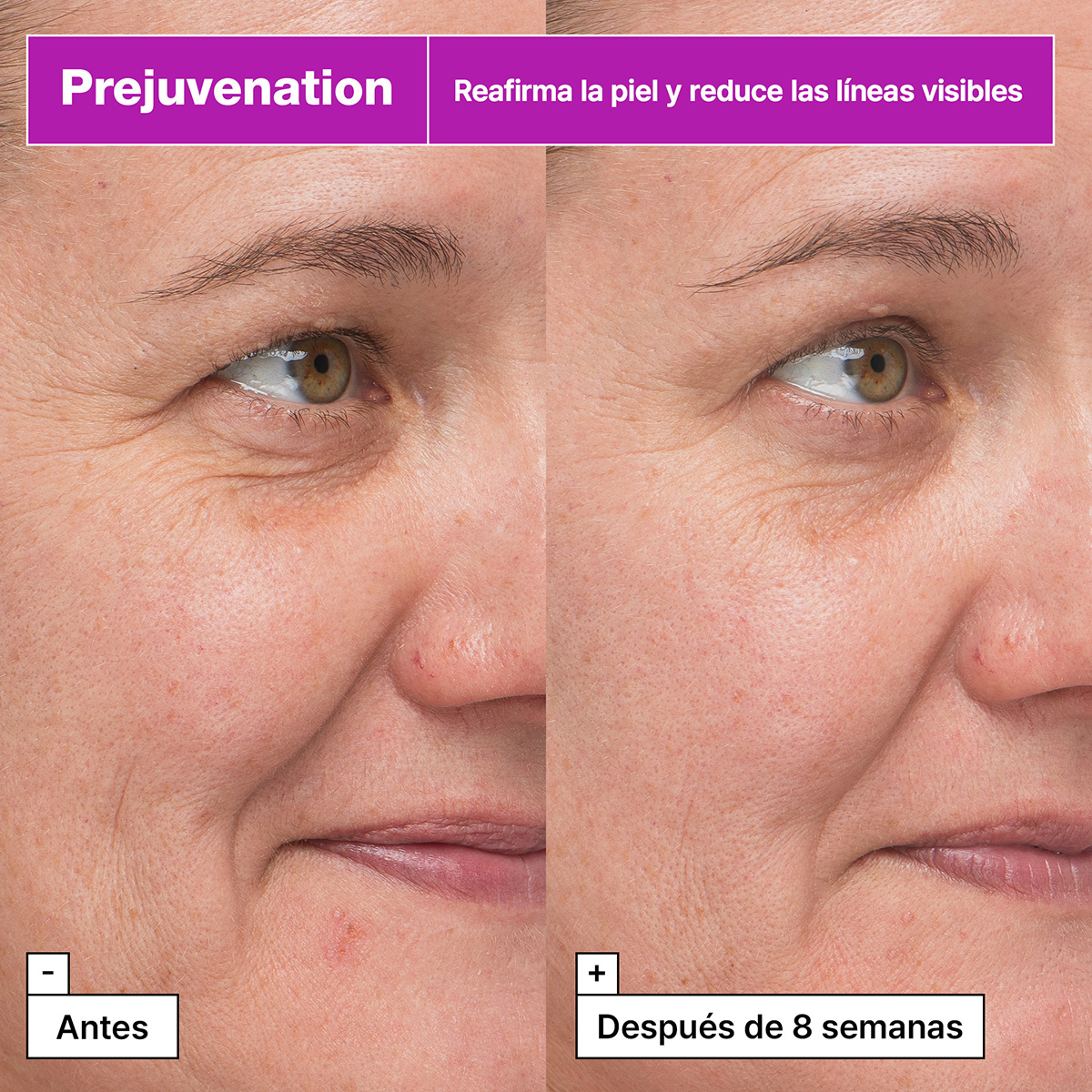 PREJUVENATION FIRMING BAKUCHIOL SERUM (SUERO PARA EL ENVEJECIMIENTO PREVENTIVO)